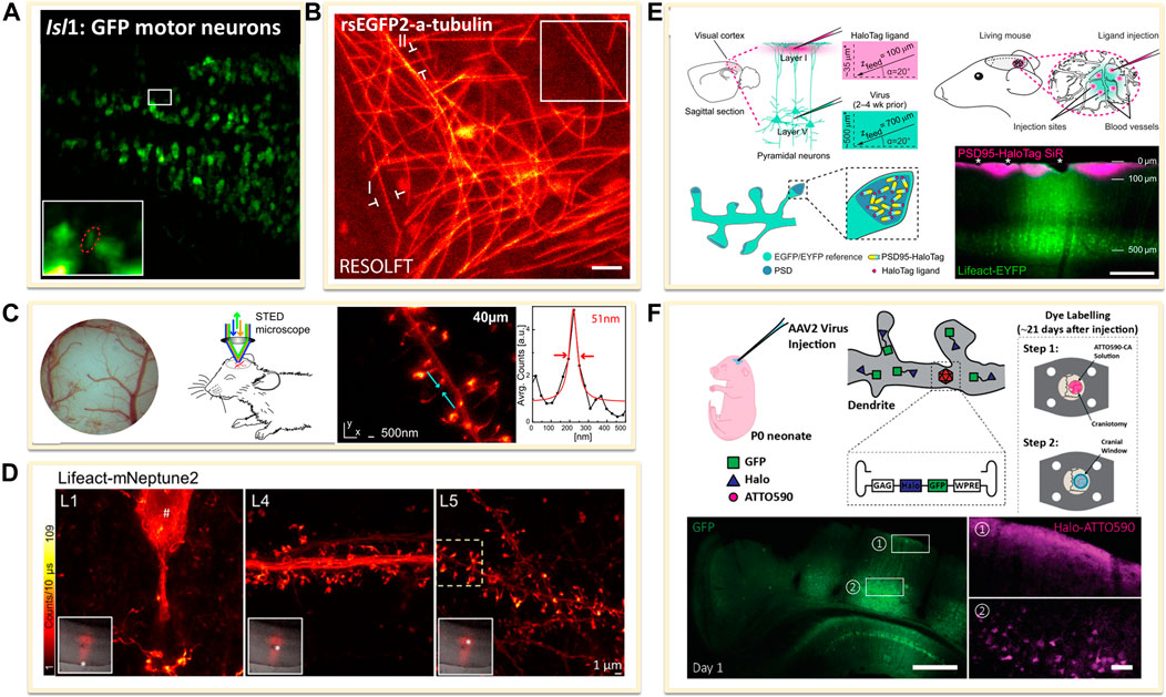 Tiny mirror improves microscope resolution fo