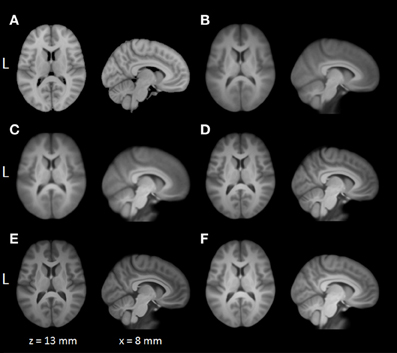 Frontiers | BROCCOLI: Software for fast fMRI analysis on many-core CPUs ...