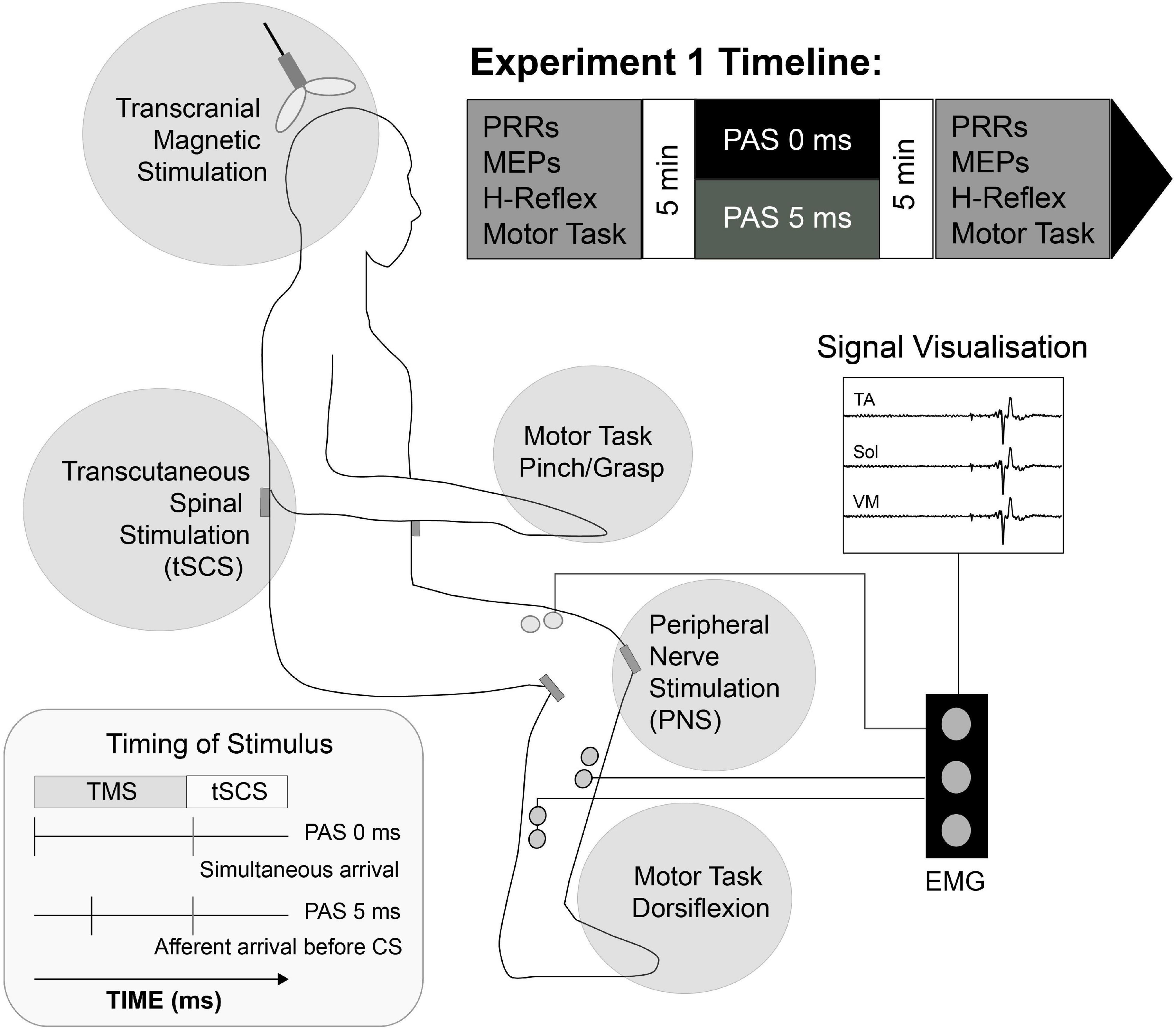 Spinal Column and Peripheral Nerve Stimulator - Back Pain Treatment