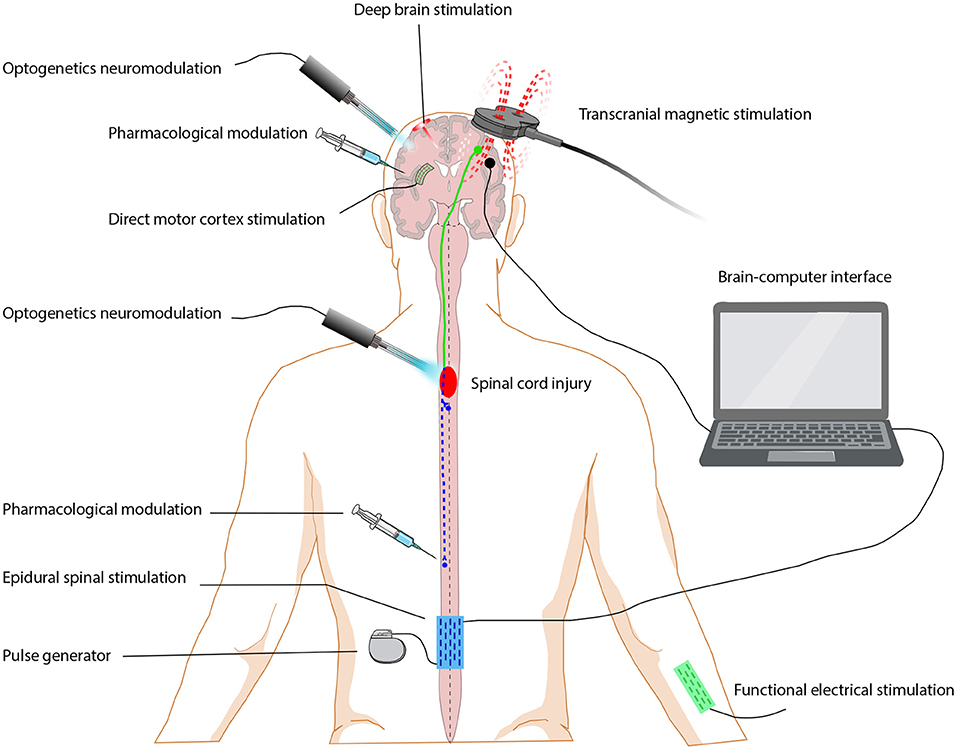 Frontiers  Neuromuscular or Sensory Electrical Stimulation for  Reconditioning Motor Output and Postural Balance in Older Subjects?