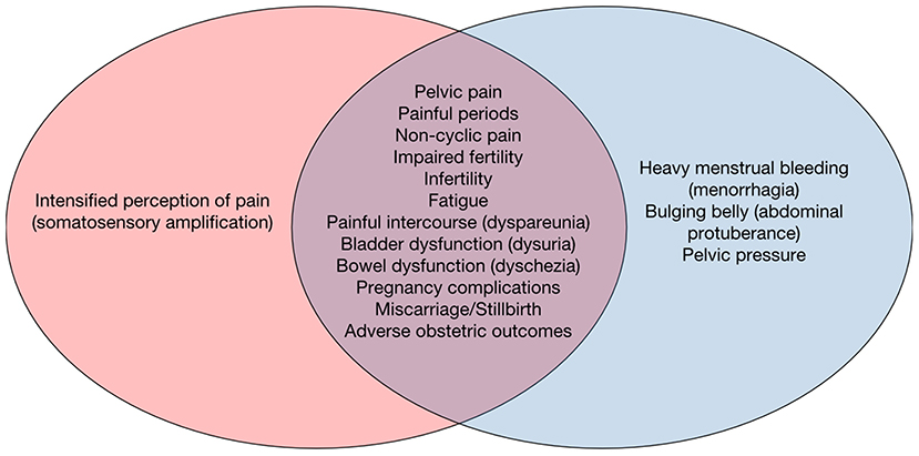 Frontiers  Endometriosis and Uterine Fibroids (Leiomyomata): Comorbidity,  Risks and Implications