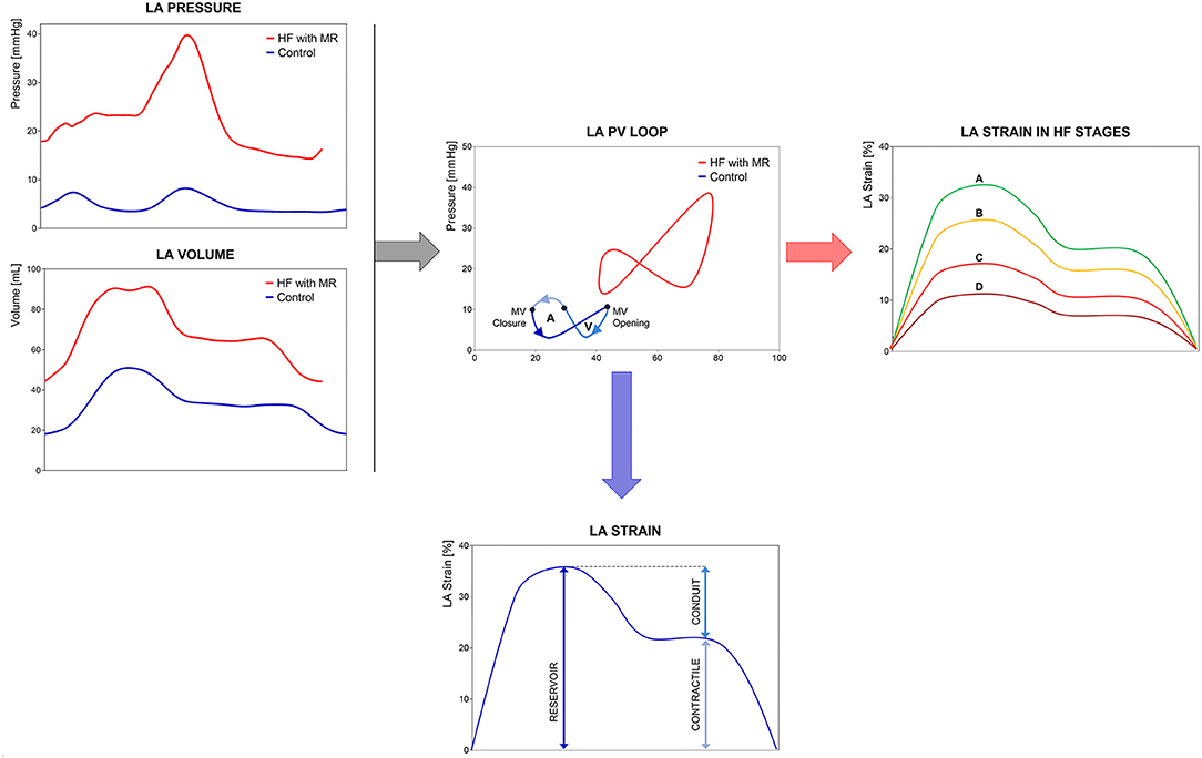 Left atrial strain by speckle-tracking: incremental role in diastolic  assessment of pediatric patients with chronic kidney disease