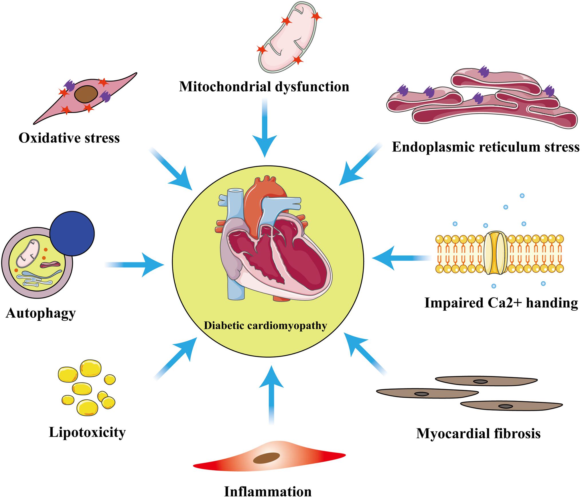 latest research diabetic cardiomyopathy