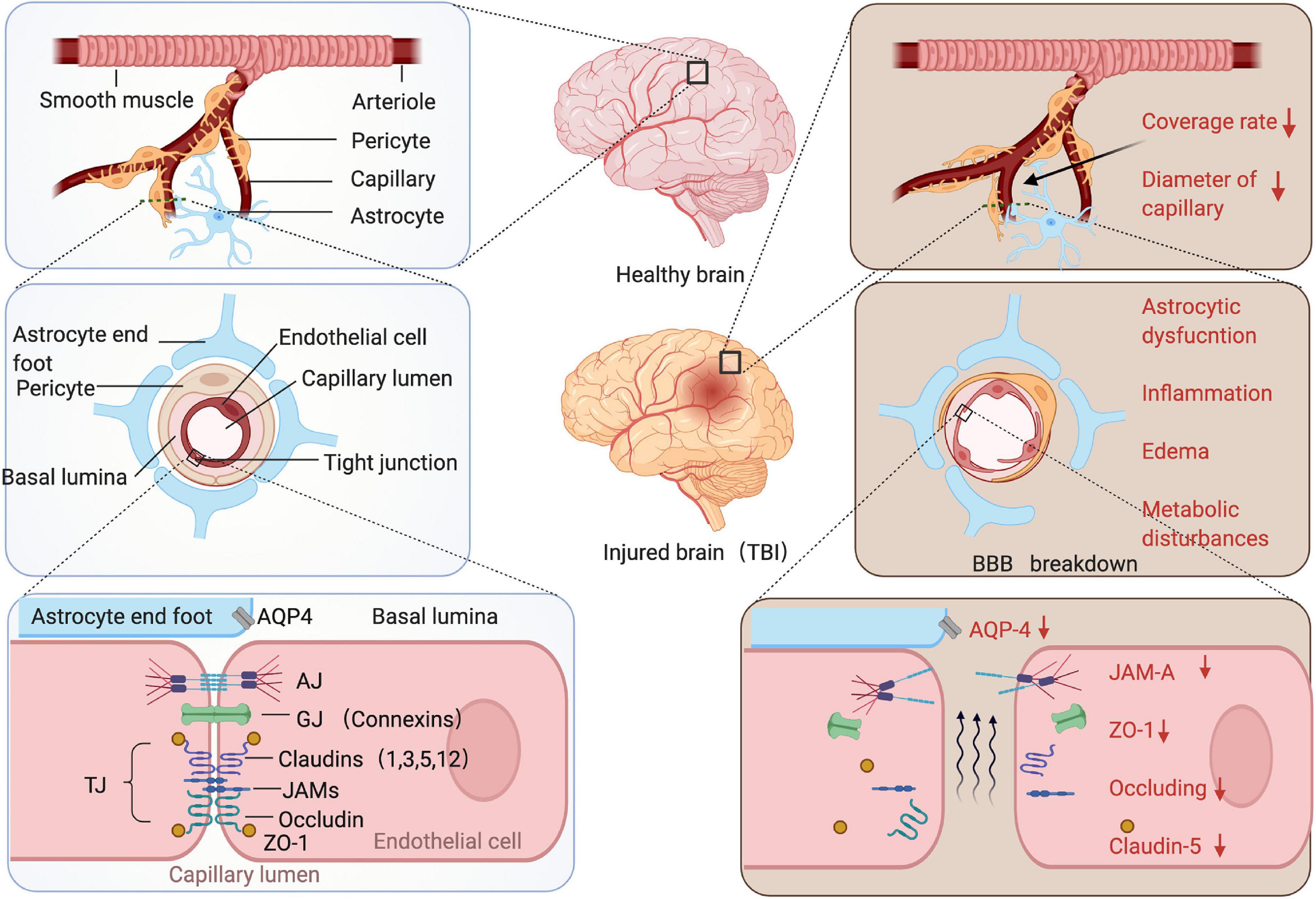 Hyperosmolar Blood brain Barrier Opening Using 48 OFF