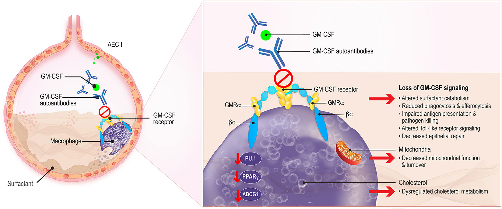 Frontiers | The Role of GM-CSF Autoantibodies in Infection and ...