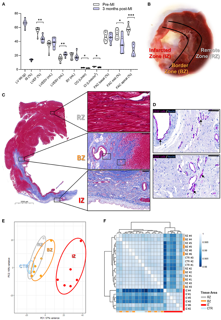 Frontiers  Transcriptome data analysis of primary cardiomyopathies reveals  perturbations in arachidonic acid metabolism