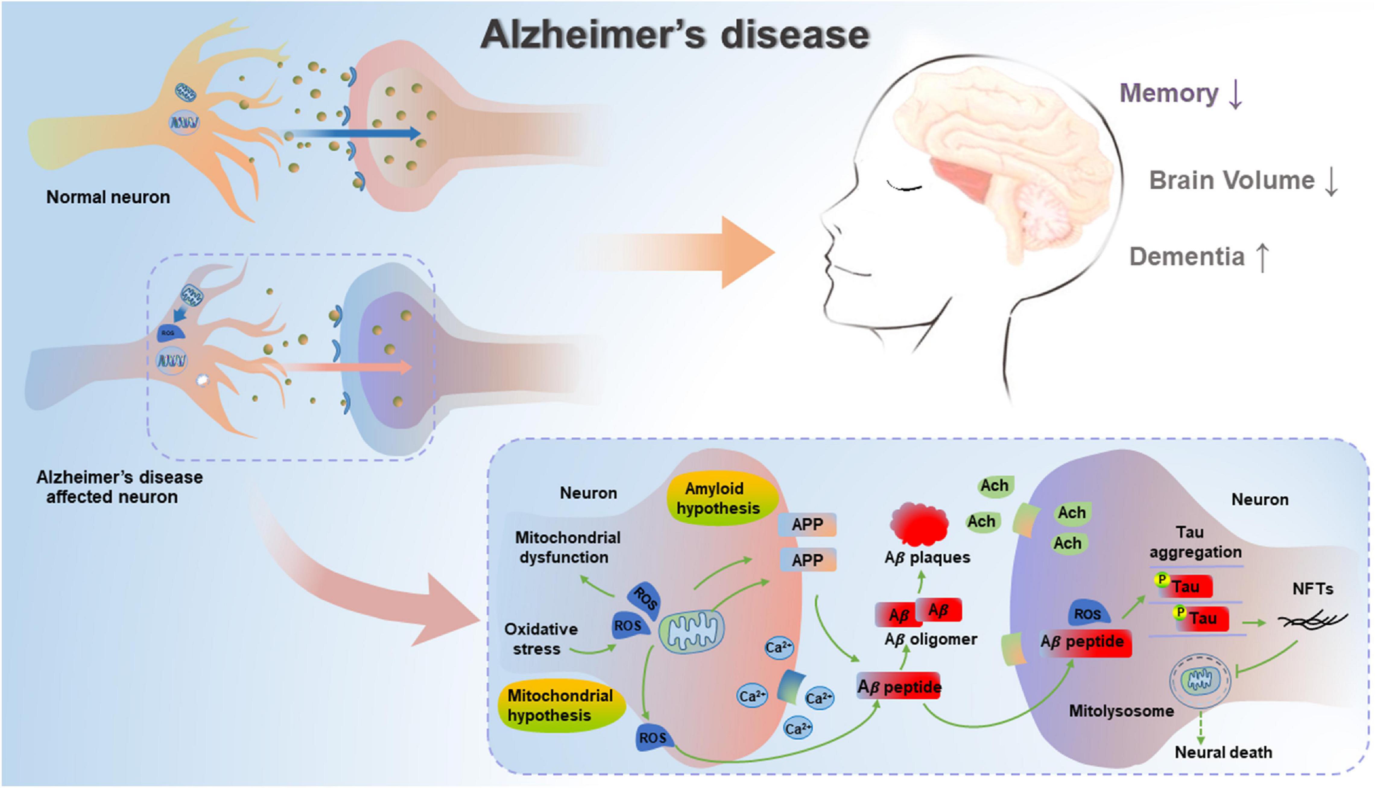 Clinical Manifestations: Alzheimer's & Dementia: Vol 19, No S4