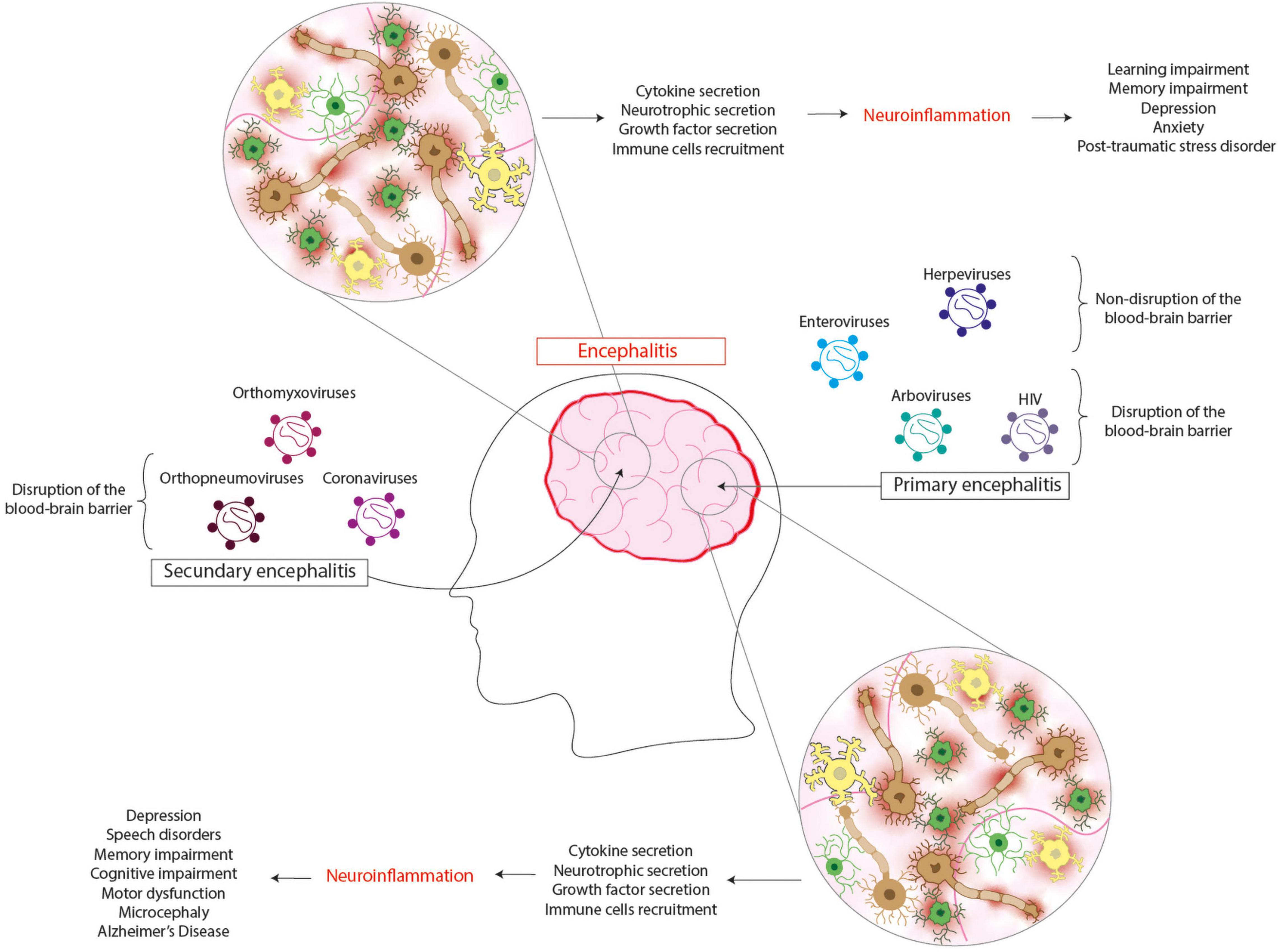 Mind Map of Encephalitis Prevention Strategies