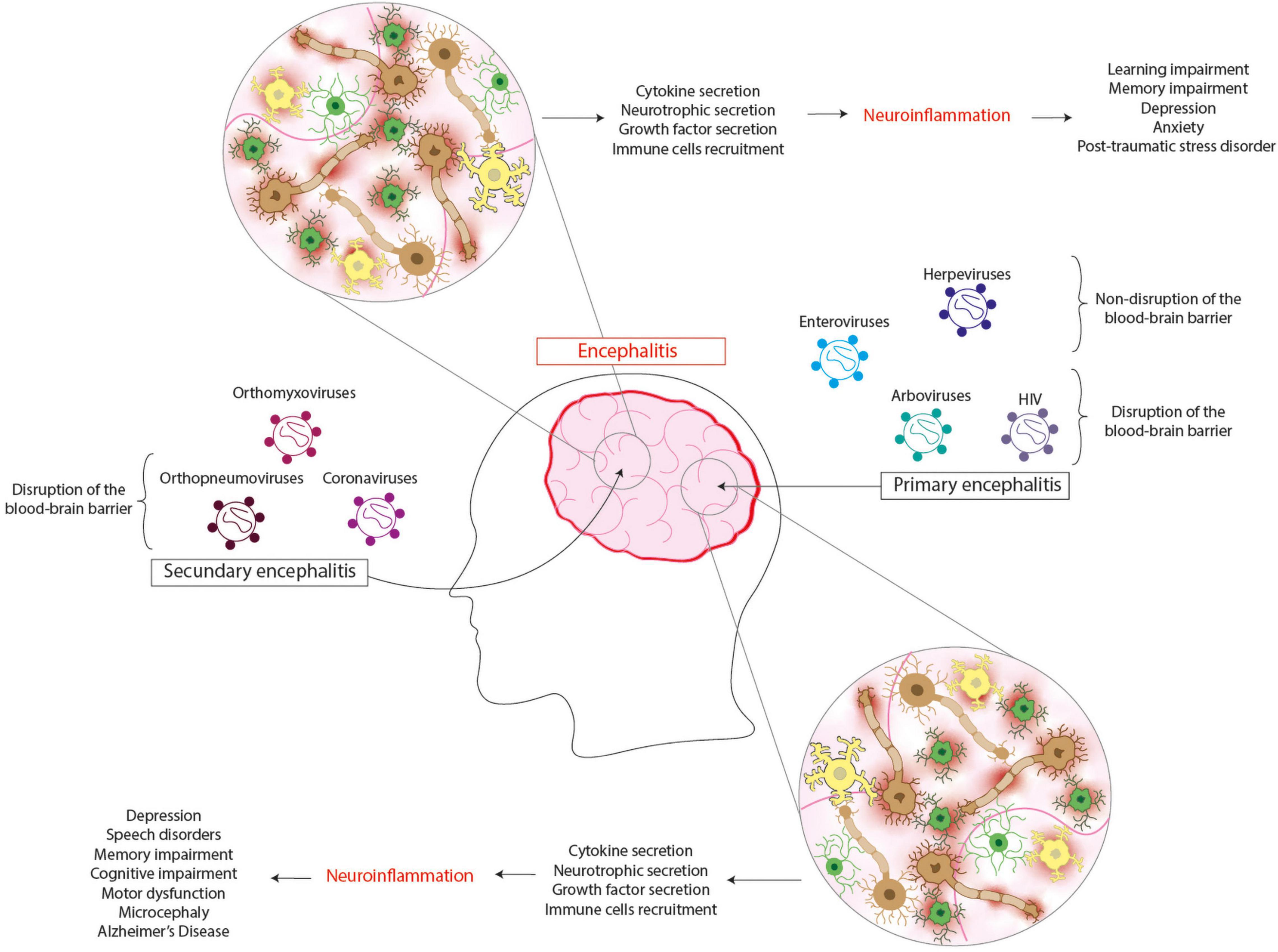 Pathophysiology Of Encephalitis