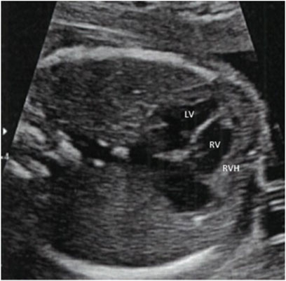 www.frontiersin.org