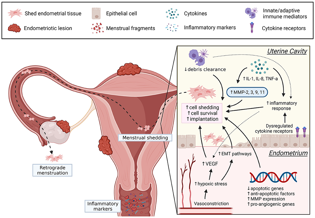 Frontiers  Menstruation Dysregulation and Endometriosis Development