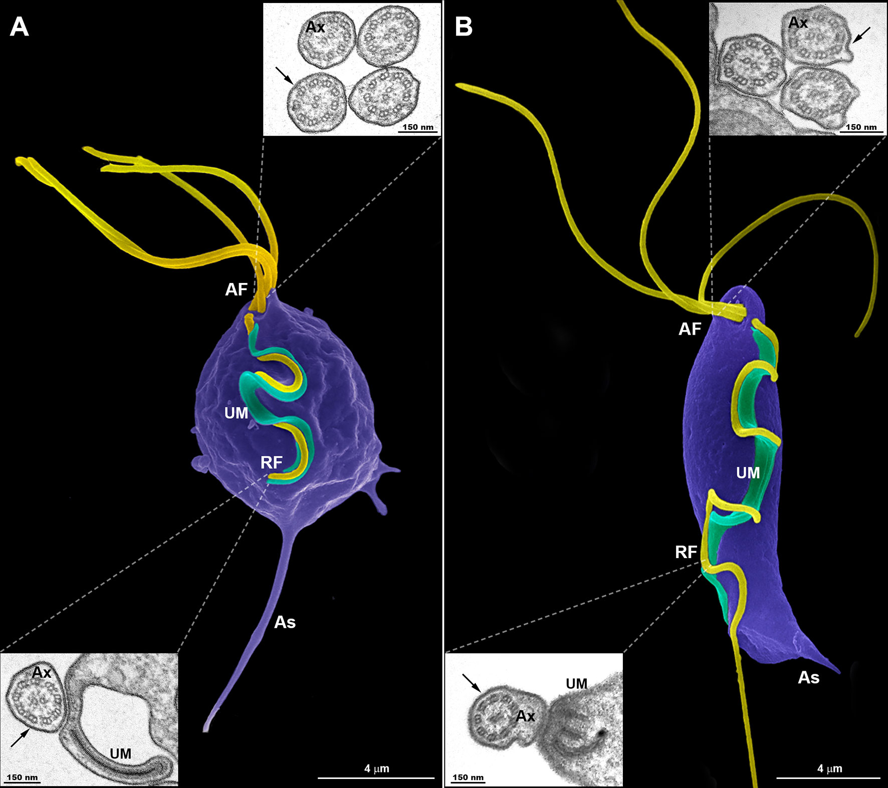 Trichomonas sp