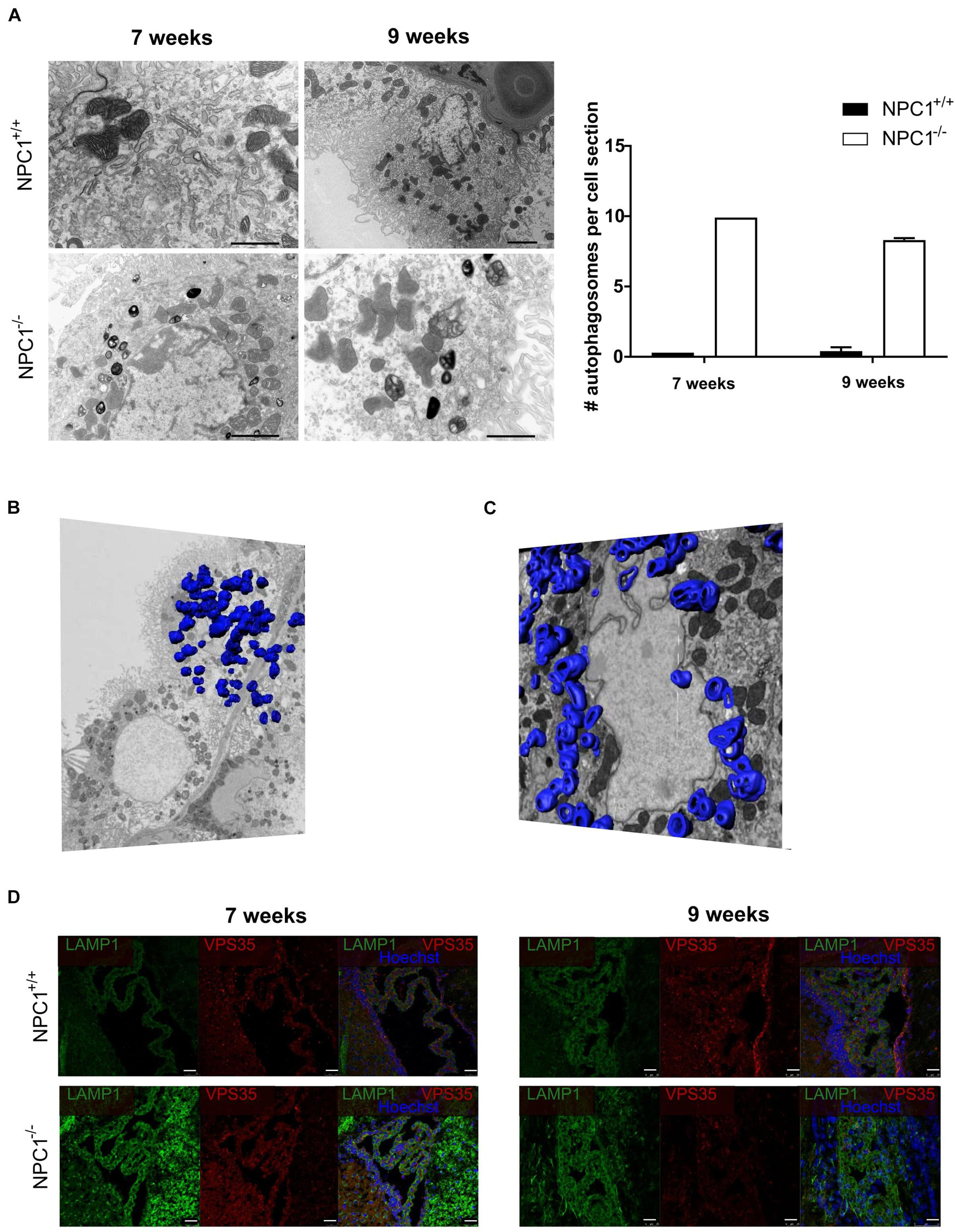 The pathogenesis of Niemann–Pick type C disease: a role for autophagy?, Expert Reviews in Molecular Medicine