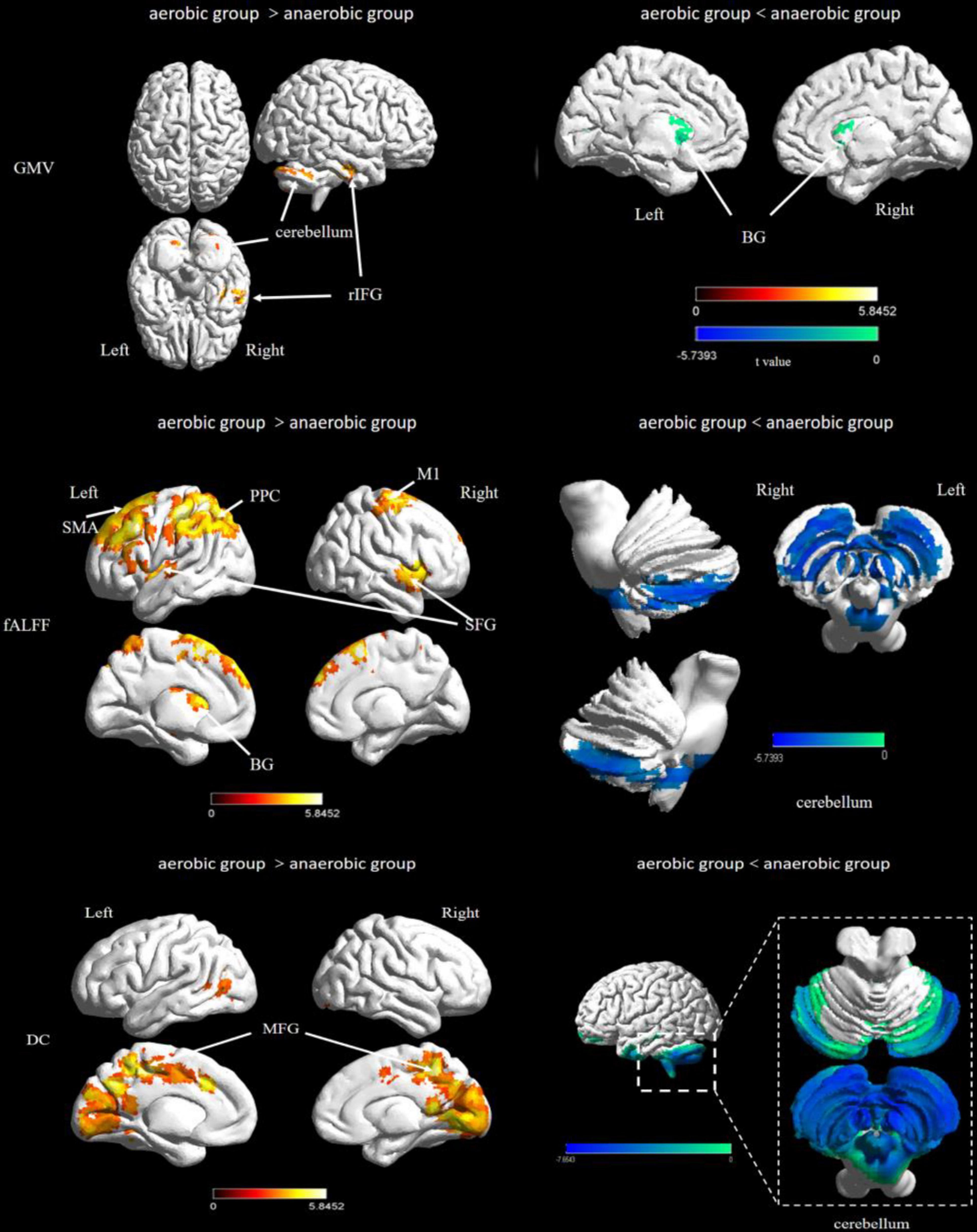 Frontiers Exercise Intensity and Brain Plasticity Whats the Difference of Brain Structural and Functional Plasticity Characteristics Between Elite Aerobic and Anaerobic Athletes?