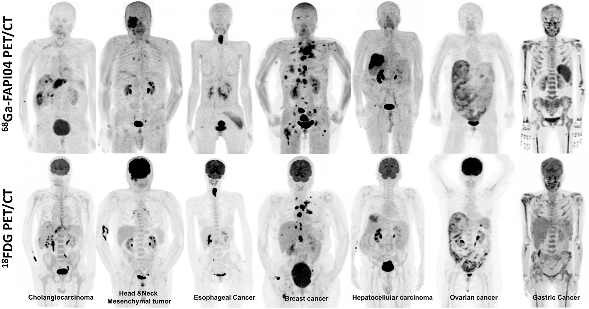 prostatitis és piros kefe