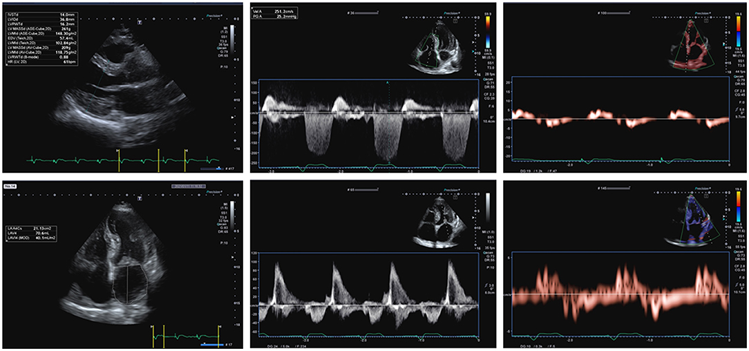 Table 4 from Visual assessment vs. strain imaging for the detection of  critical stenosis of the left anterior descending coronary artery in  patients without a history of myocardial infarction.