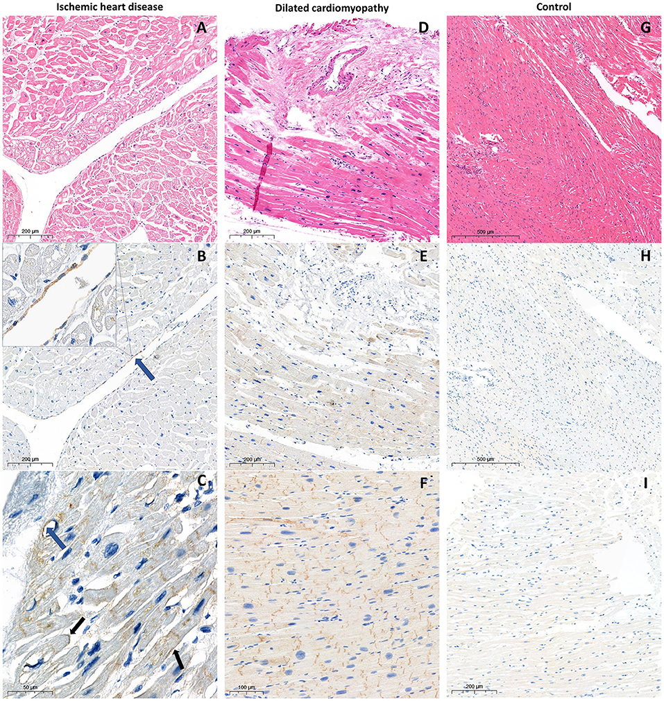 Diagnostic Pathology: Cardiovascular: Miller MD, Dylan V