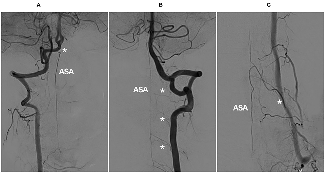 Adam A Richter, MD, Vascular Surgery