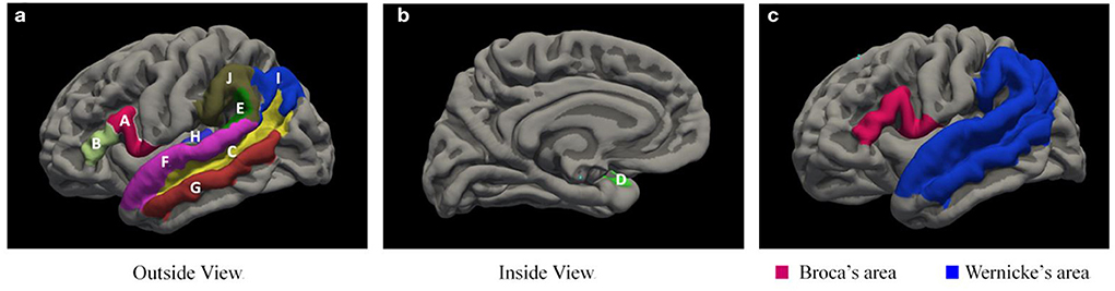 Wernicke's & Broca's aphasia Brain & Language LING 411/412/489