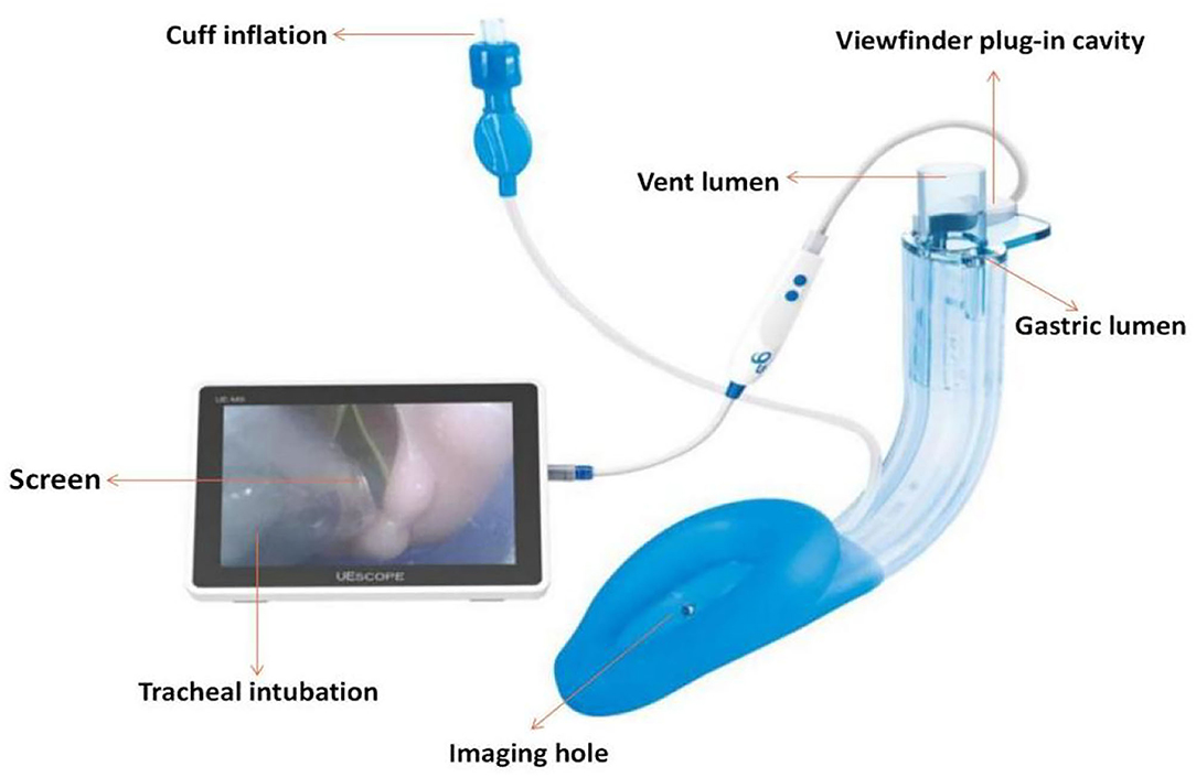 Block Buster Laryngeal Mask Airway