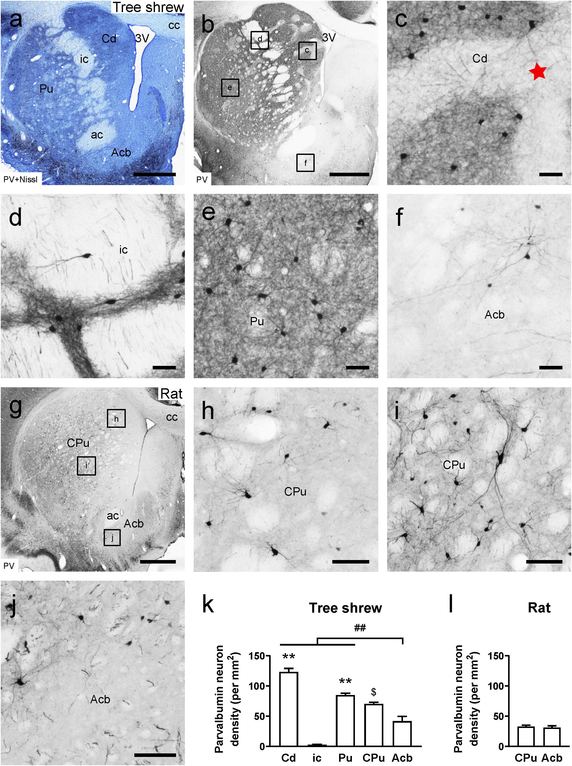 lsm.jpg4.us | imagesize: lsd-012 Frontiers | Whole-Brain Afferent Inputs to the Caudate Nucleus, Putamen,  and Accumbens Nucleus in the Tree Shrew Striatum