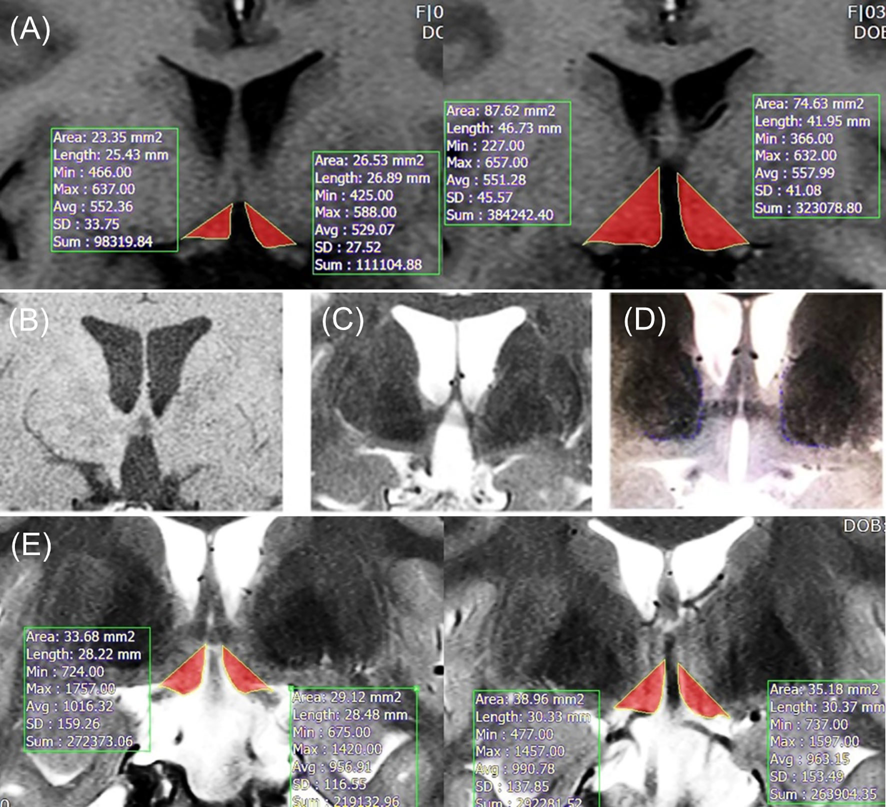 Body Measurement: Area mm2 to m2 ?