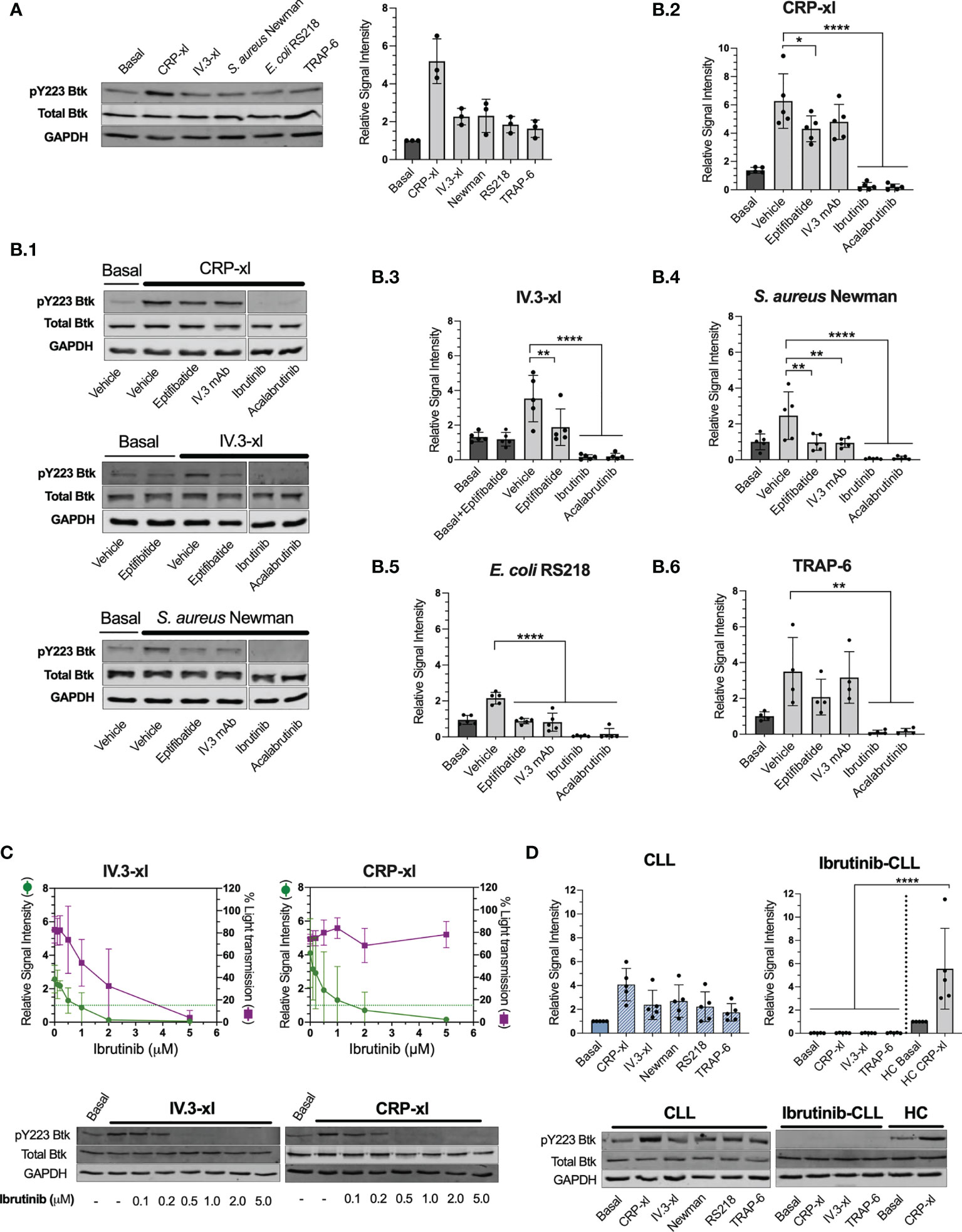 Relative Selectivity of Covalent Inhibitors Requires Assessment of  Inactivation Kinetics and Cellular Occupancy: A Case Study of Ibrutinib and  Acalabrutinib