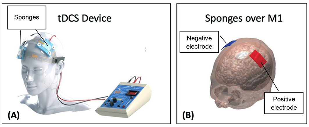 图2 - (A)带海绵的tDCS装置。
