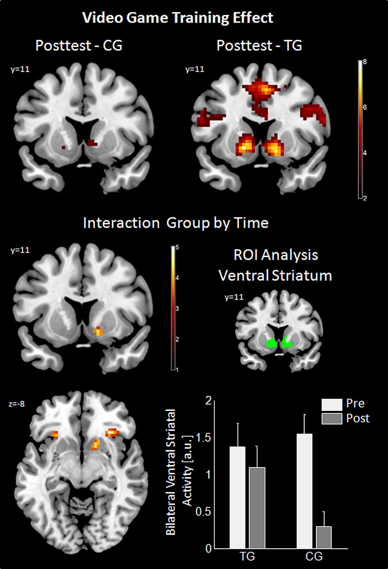 Gamification and dopamine: why games motivate us - Playmotiv