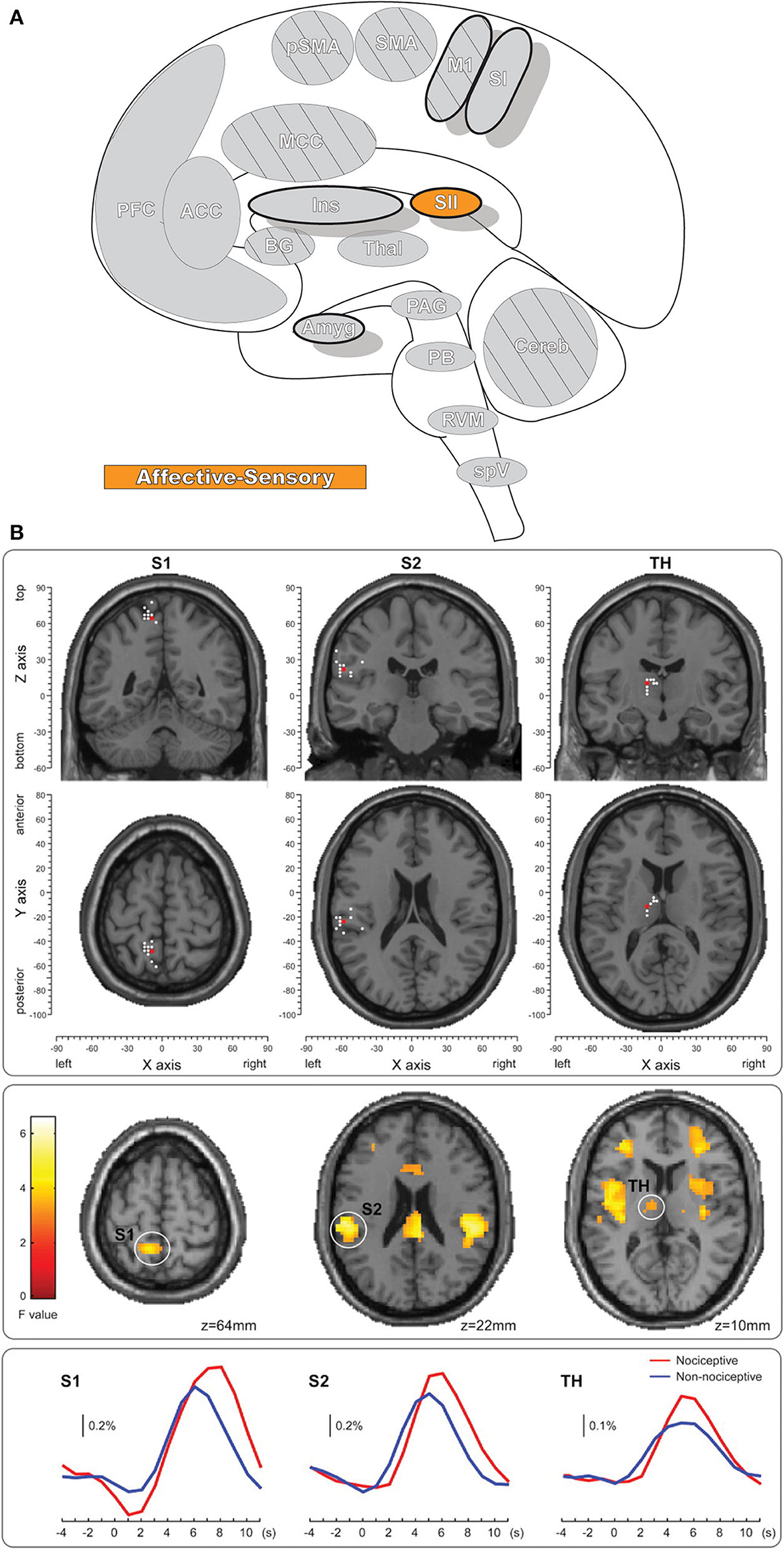 Brain Test All Levels 1-423 Answers Brain Test All Levels Solution (Full  Detailed Guide) 