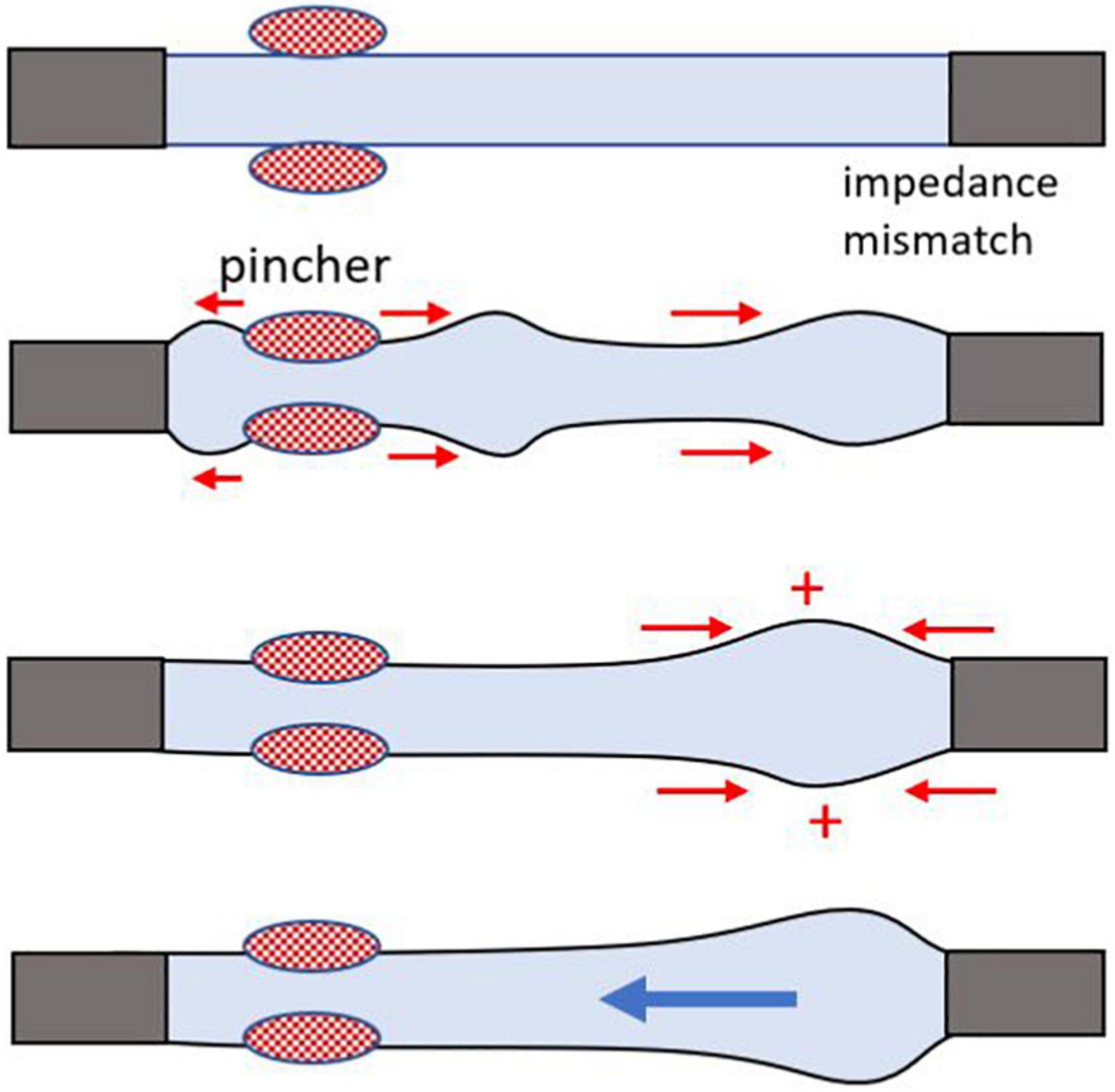 Sperm Pump