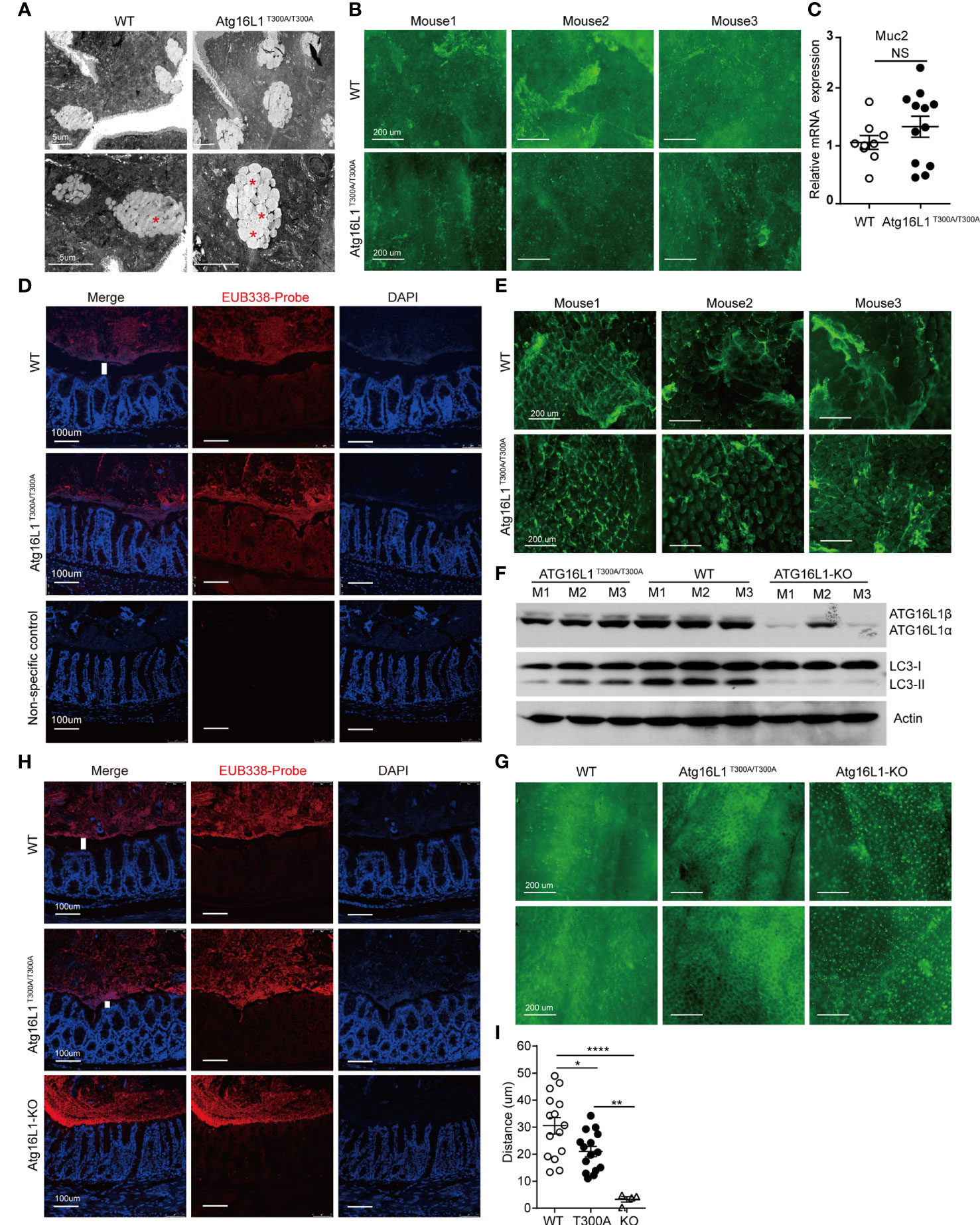 Frontiers | IBD-Associated Atg16L1T300A Polymorphism Regulates ...