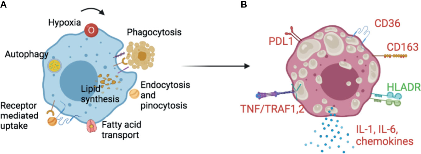 Caseum development is the process of lipid enrichment with necrosis