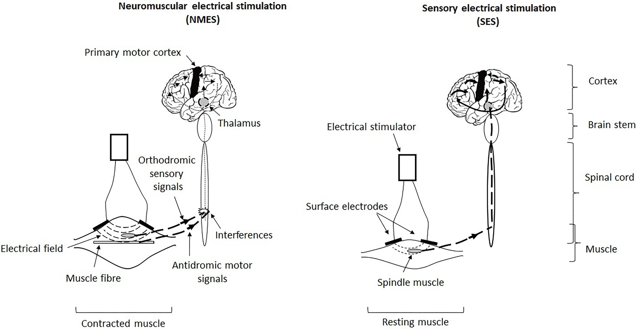 Frontiers  Neuromuscular or Sensory Electrical Stimulation for  Reconditioning Motor Output and Postural Balance in Older Subjects?