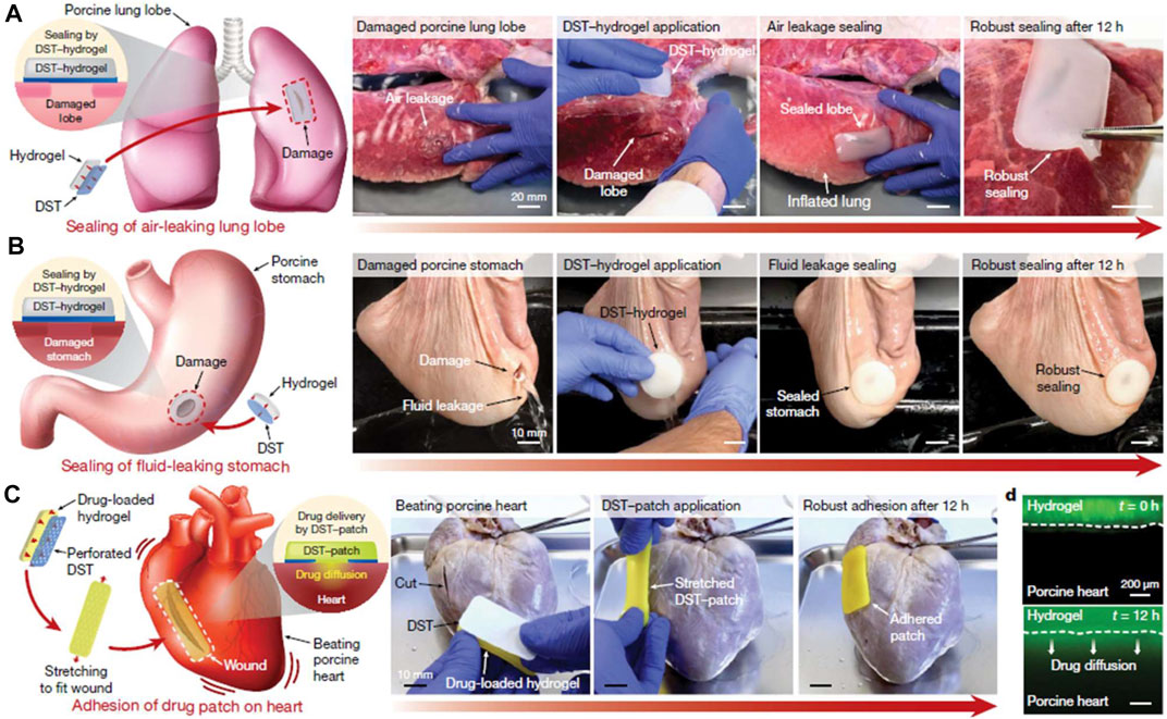 Powerful Fibrin Glue For Strength 