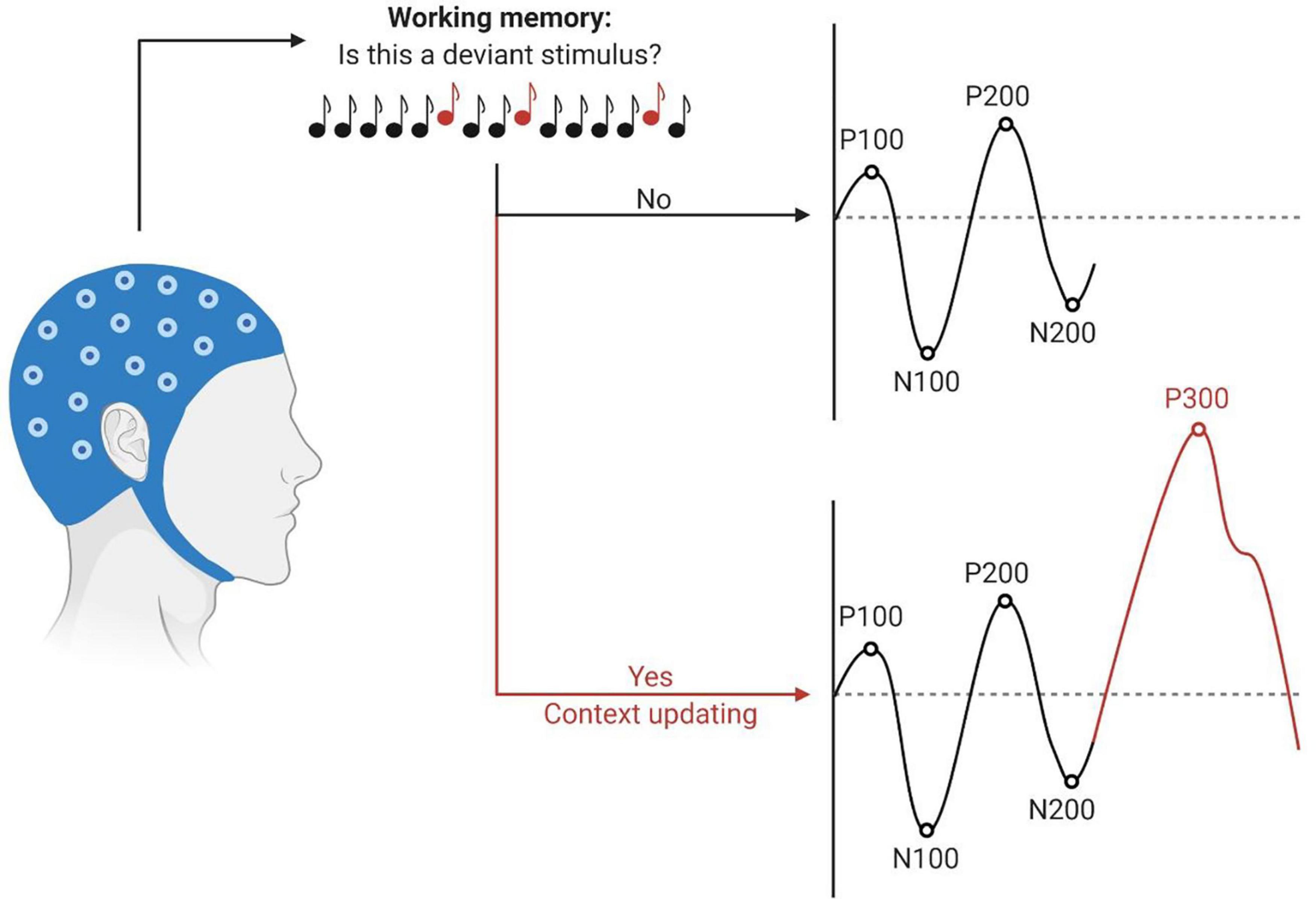 Automated cortical auditory evoked potentials threshold estimation in  neonates☆