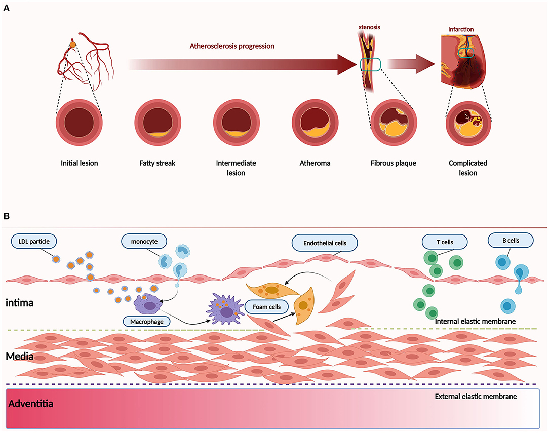 Frontiers  The Emerging Role of Rho Guanine Nucleotide Exchange Factors in  Cardiovascular Disorders: Insights Into Atherosclerosis: A Mini Review