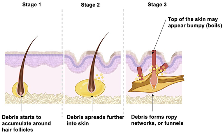 Pin by Dr S D Sharma on Health in 2023  Skin clinic Skin boil Skin  treatments