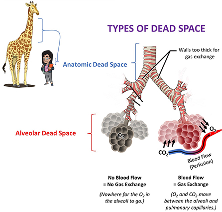 Figure 2 - Anatomic dead space includes parts of the respiratory system where gas exchange cannot occur, such as the trachea.