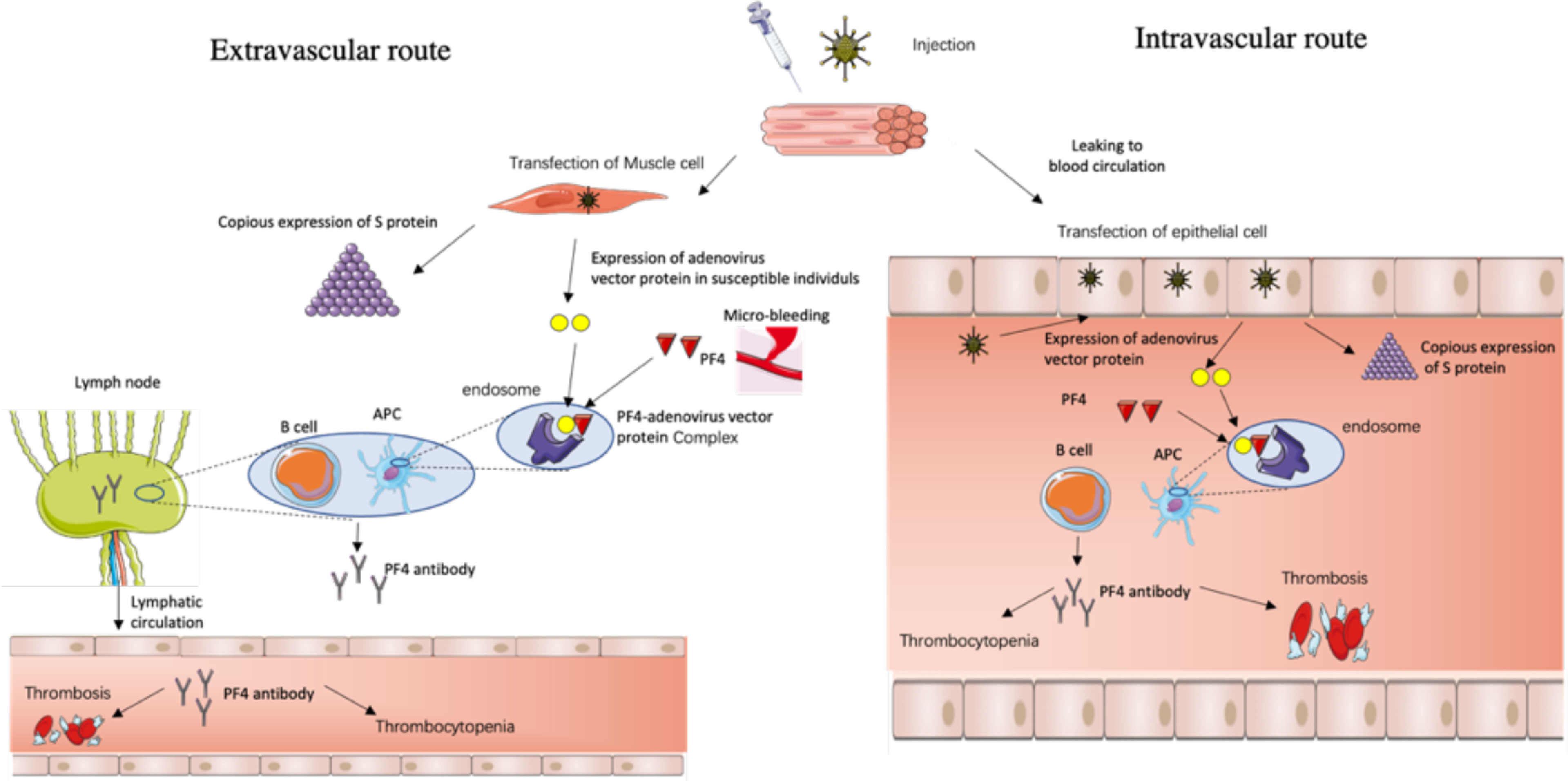 Thrombosis with thrombocytopenia syndrome