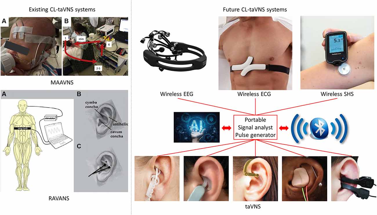 Non-Invasive Vagus Nerve stimulation Devices: Technology