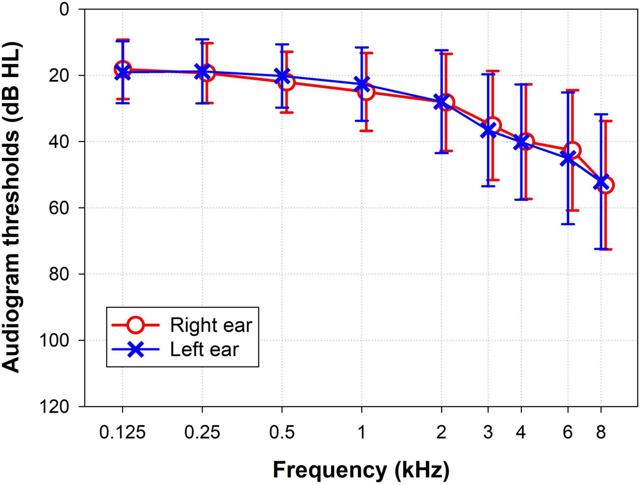 Frontiers  Speech Perception and Dichotic Listening Are Associated With  Hearing Thresholds and Cognition, Respectively, in Unaided Presbycusis