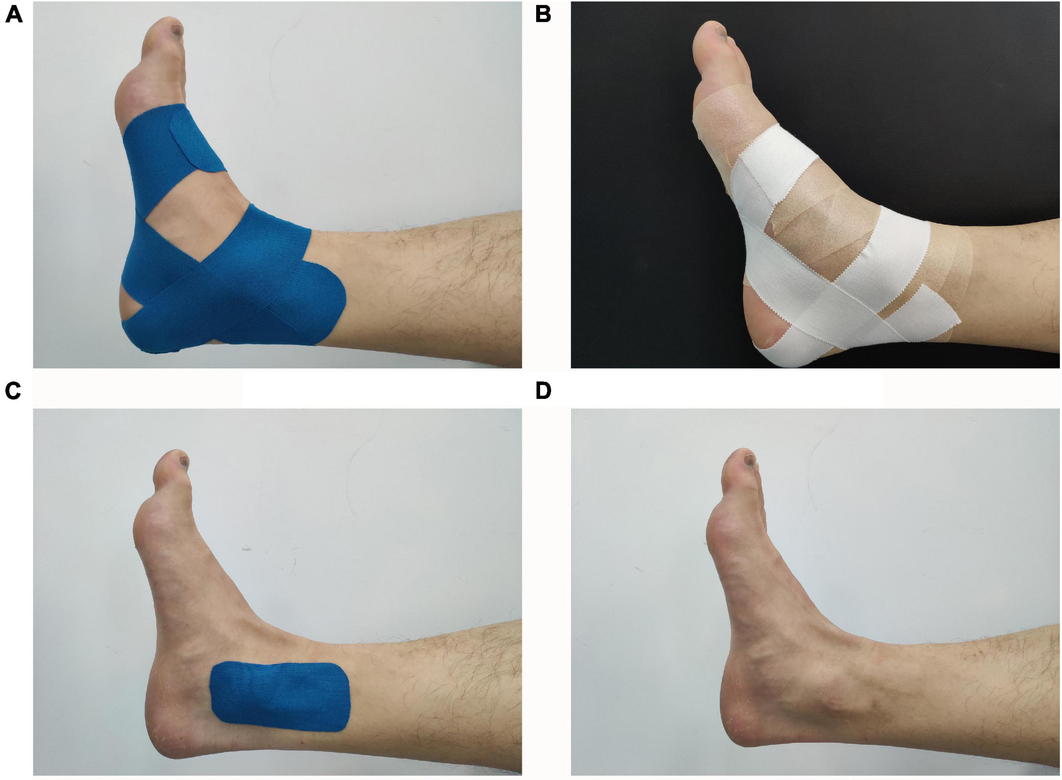 Kinesio tape application to the knee and thigh of the injured leg