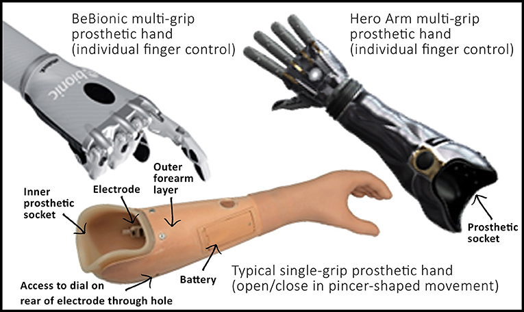 Figure 1 - Examples of myoelectric prosthetic arms.
