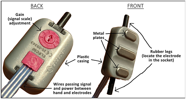 Figure 2 - An electrode used to control a myoelectric prosthetic hand.