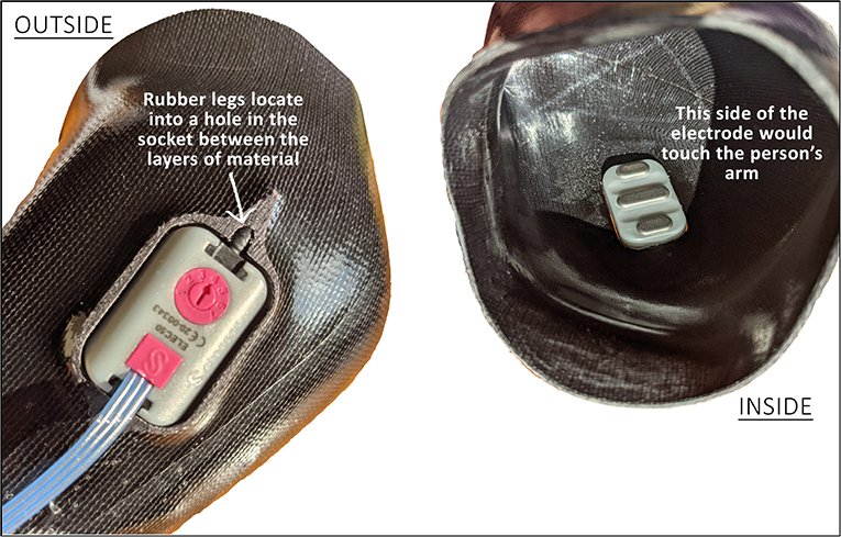 Figure 3 - The electrodes fit into a hole in the inner socket that is shaped around the person’s arm.