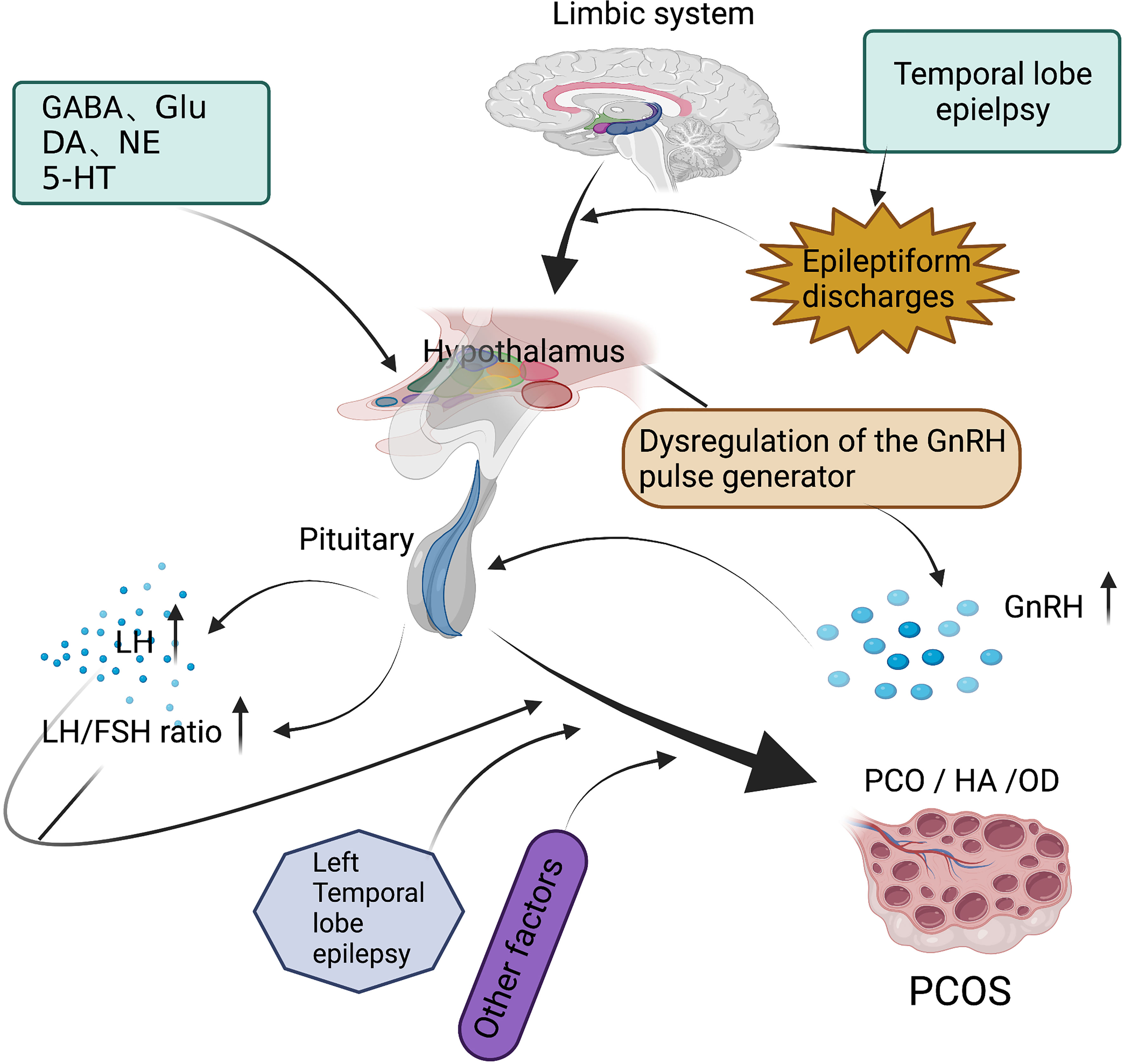 pcos research articles 2021