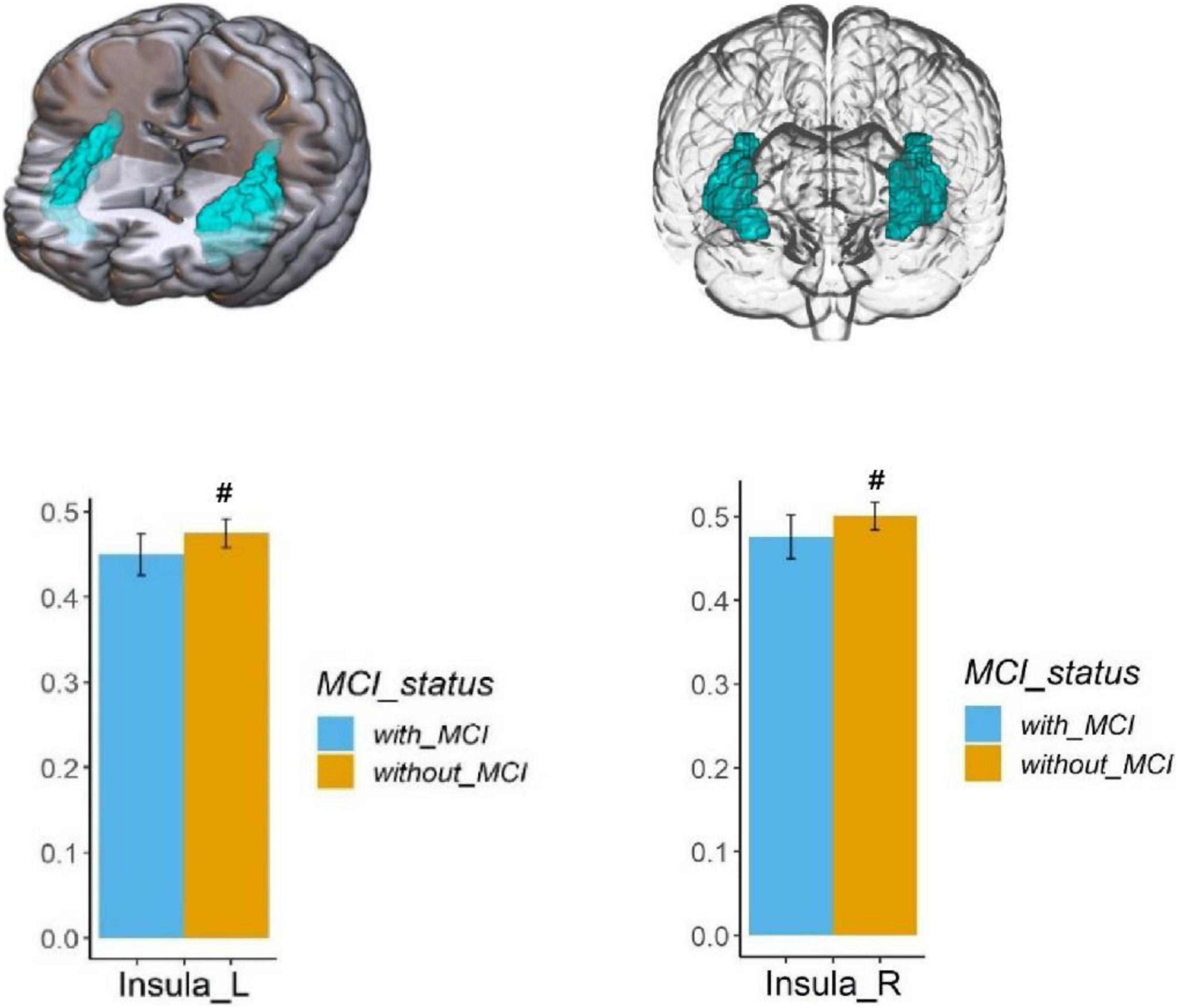 Frontiers Effects of Chronic Hypoxic Environment on Cognitive Function and Neuroimaging Measures in a High-Altitude Population picture