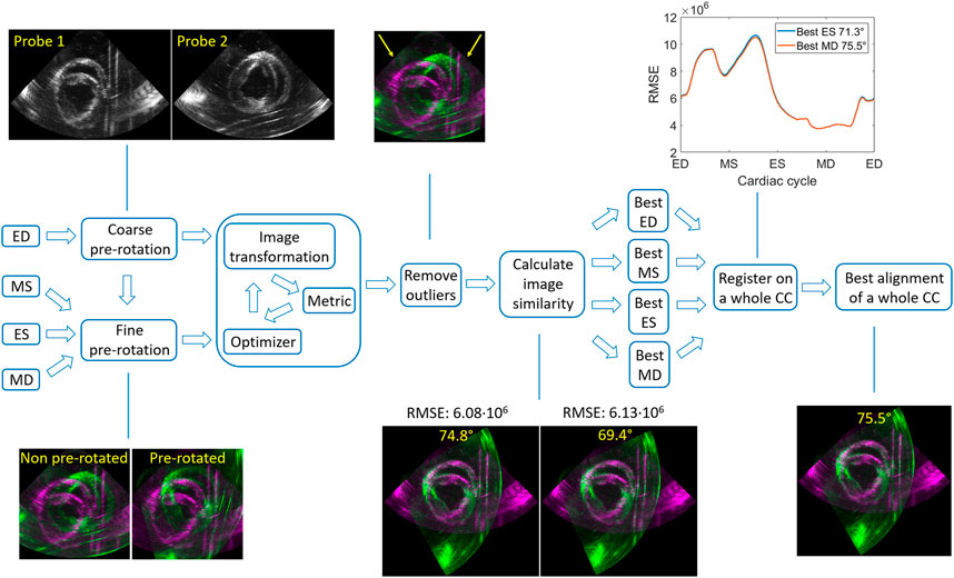 Advances in echocardiography: global longitudinal strain, intra-cardiac  multidirectional flow imaging and automated 3d volume analysis