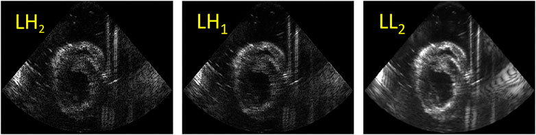 Principles and Practical Aspects of Strain Echocardiography